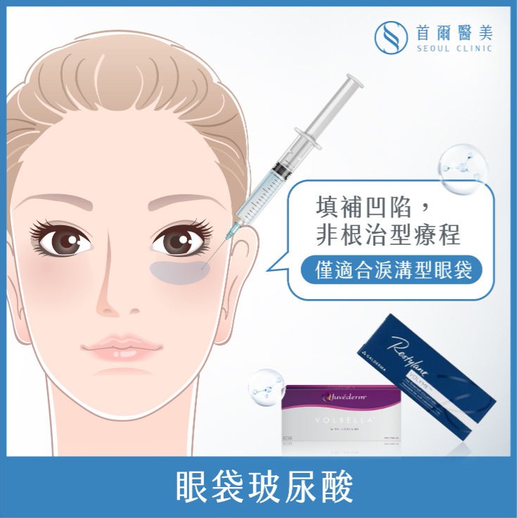 眼袋_眼袋玻尿酸_首爾醫美診所
