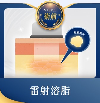 三合一抽脂手術-術前雷射溶脂-首爾醫美