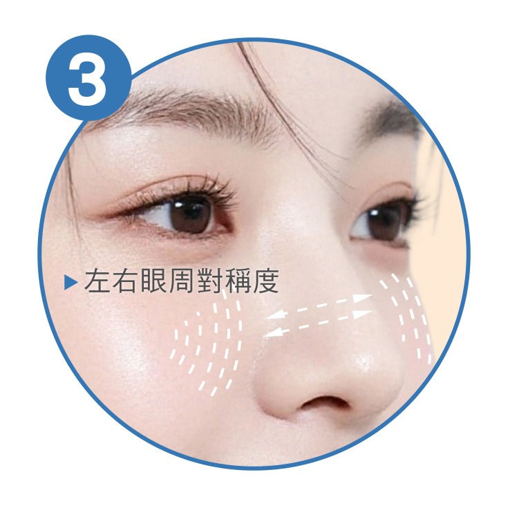 雙眼皮手術_自然閉眼折痕_首爾醫美