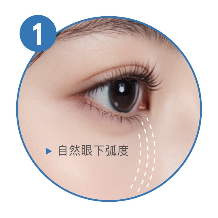 雙眼皮手術_適合的眼型比例_首爾醫美