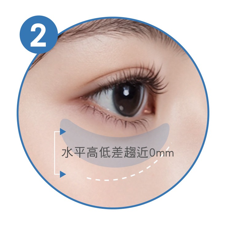 雙眼皮手術_適當眼珠露出程度_首爾醫美