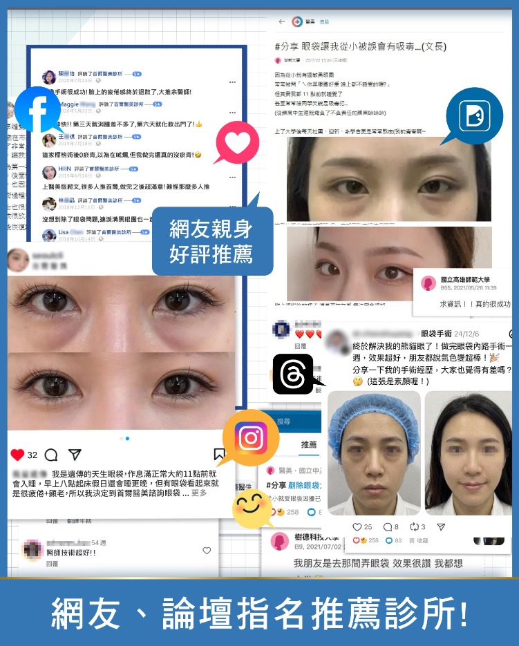 眼袋手術-口碑5星好評診所-首爾醫美診所