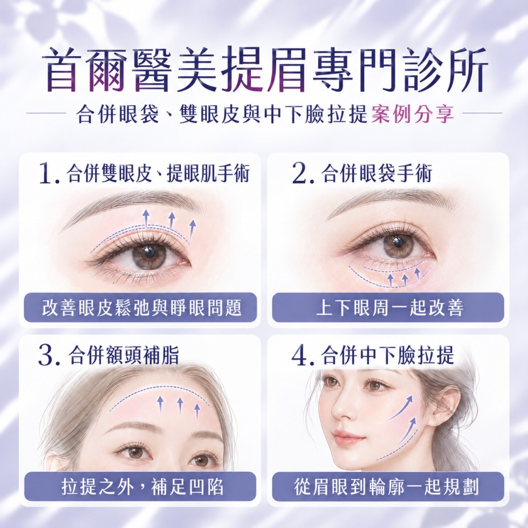 首爾醫美隆鼻手術_療程介紹