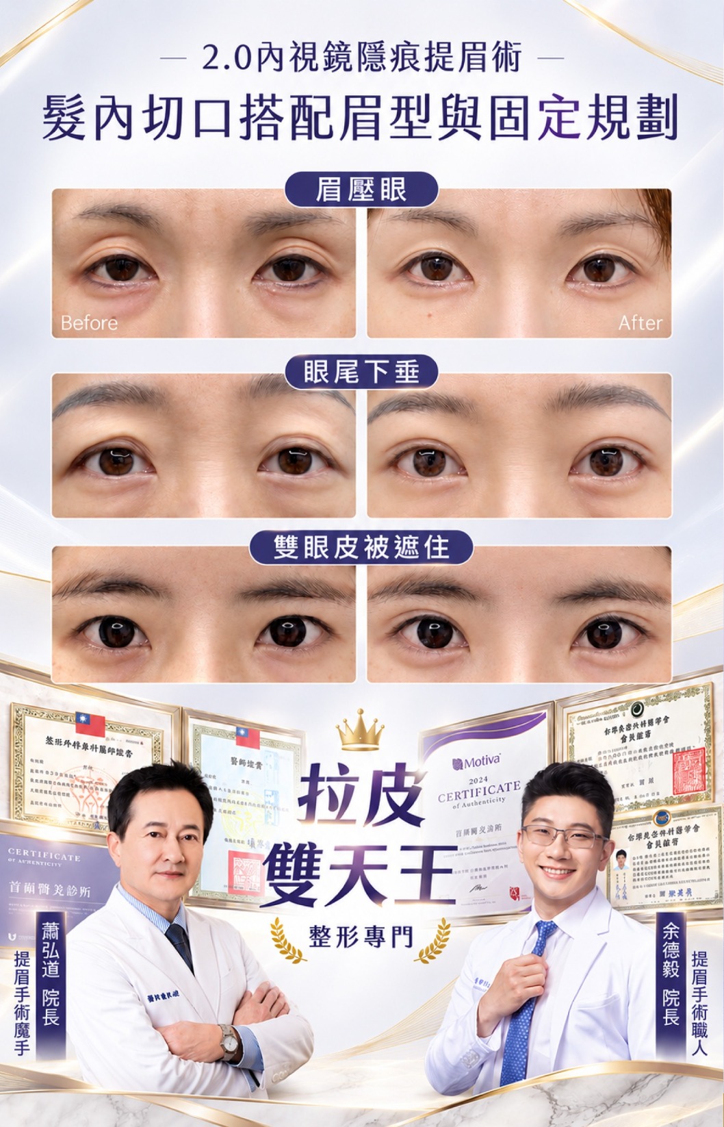 首爾醫美隆鼻手術_療程介紹